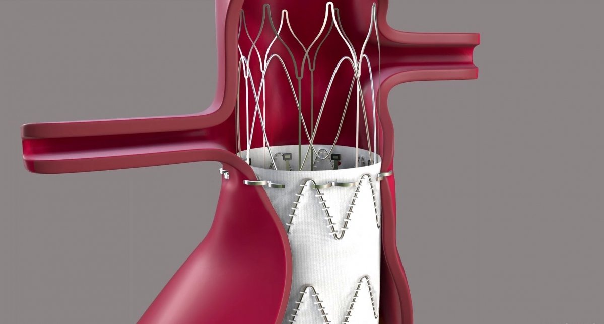 © Endoron Medical
