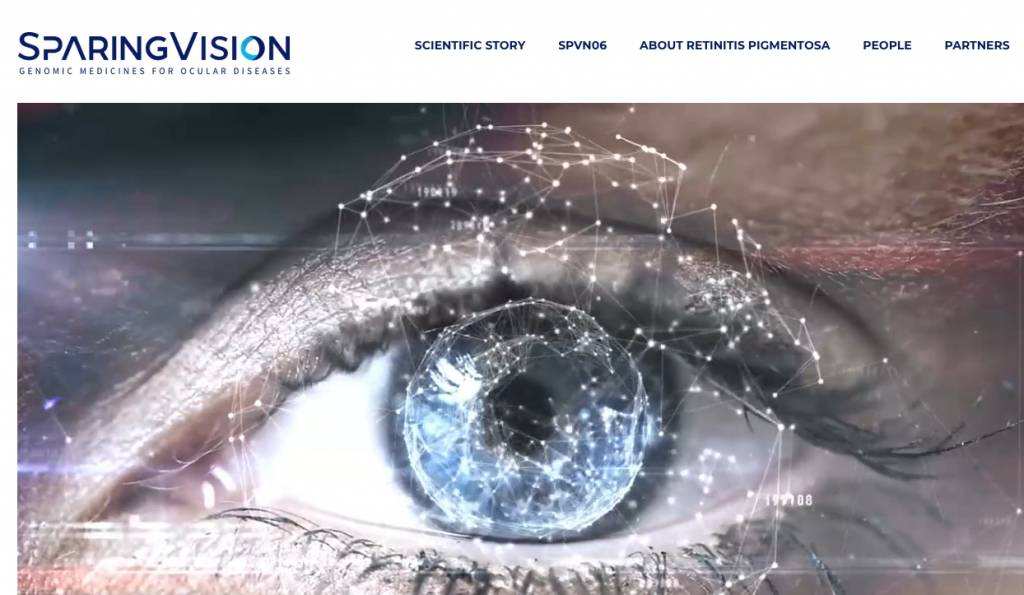 SparingVision