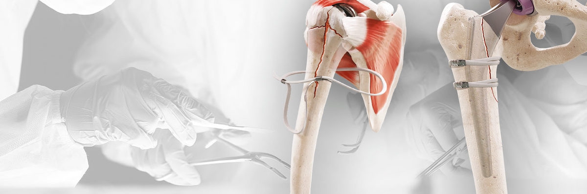 &copy; FH Ortho