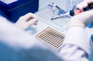 Transgene UNE